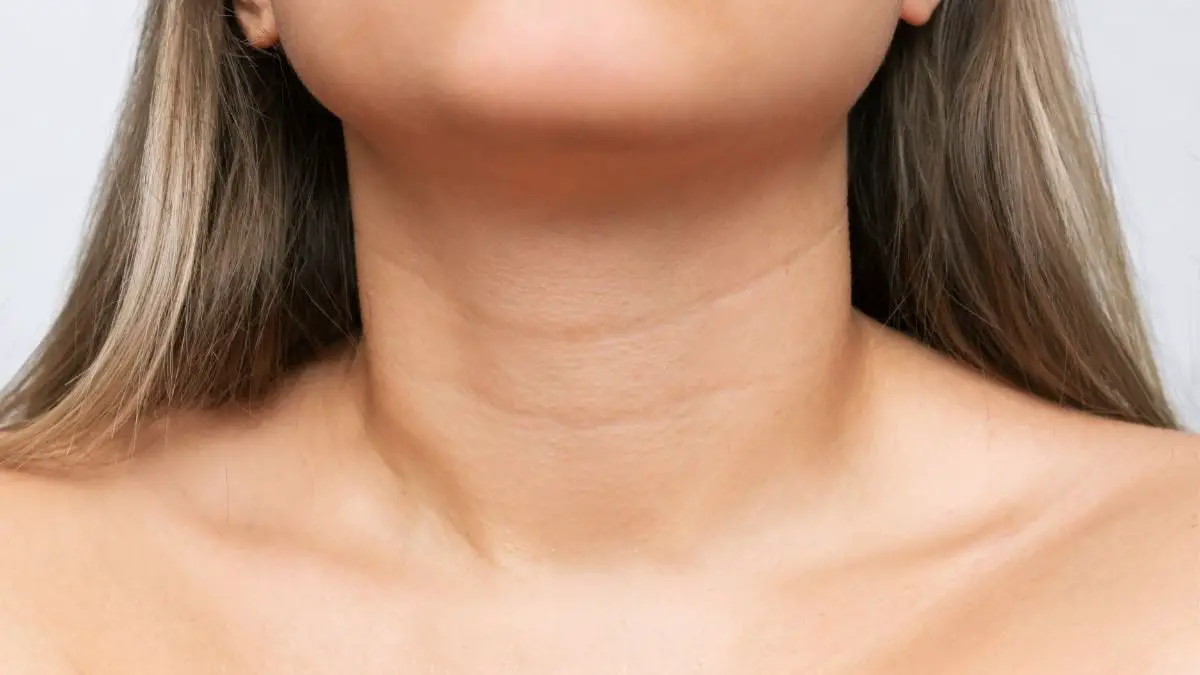 How to Remove Neck Lines Effective Methods for a Youthful Neck